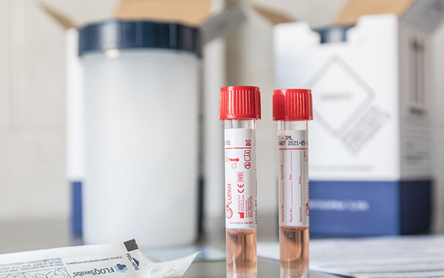 V laboratoři nemocnice vyšetřili v říjnu  na koronavirus 12 tisíc vzorků.