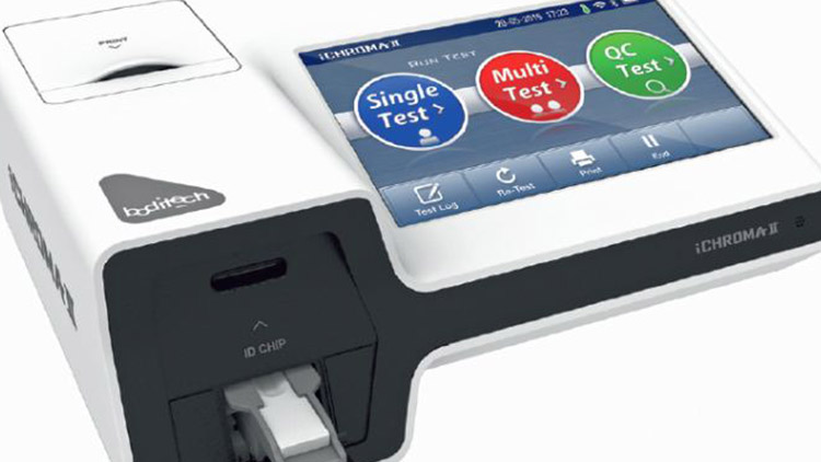 Prostějovský Rotary klub pořídil revoluční přístroj testující covid