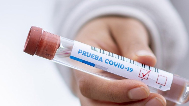 Vékáčko na testování využívá služeb agentury