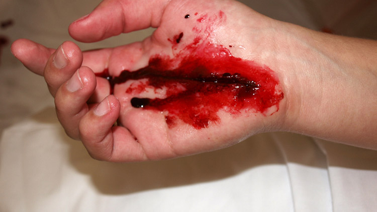 Na Silvestra tekla krev!