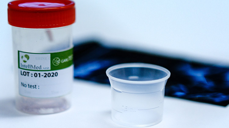 Kraj spouští pilotní projekt testování žáků středních škol