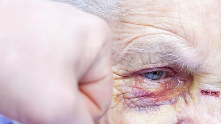 Přizabil seniora, pak ho okradl!