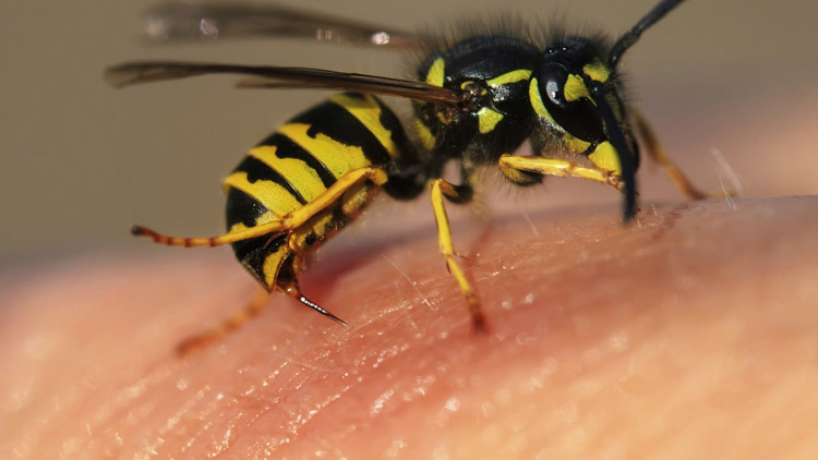 Jak ošetřit bodnutí hmyzem  a kdy už je nutné volat lékaře?