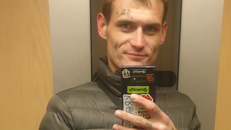 „Krade dál. Pavel Bradáč si zranil nohu při útěku před policisty!“  