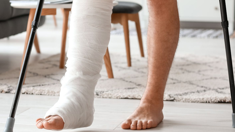 K moři i se zlomenou nohou