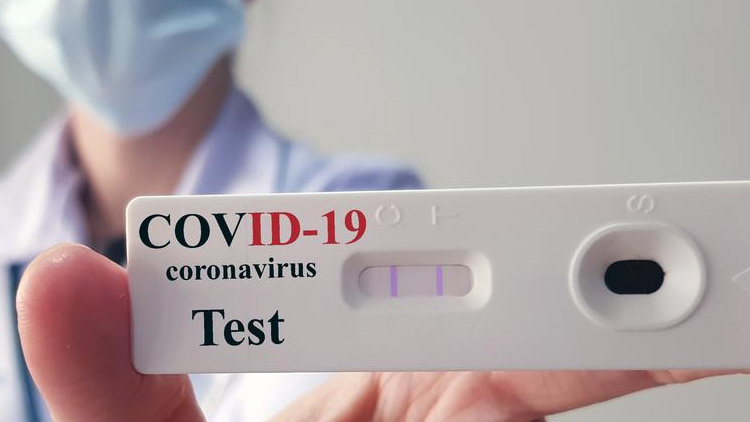 Počet pozitivně testovaných poklesl o 644 případů