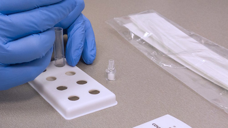 Zájem firem o samo-testovací sady neustále roste